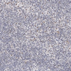 Invitrogen ThPOK Polyclonal Antibody 100 &mu;L; Unconjugated:Antibodies,