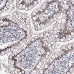 Invitrogen ThPOK Polyclonal Antibody 100 &mu;L; Unconjugated:Antibodies,