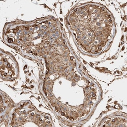 Invitrogen ZNF397 Polyclonal Antibody 100 &mu;L; Unconjugated:Antibodies,