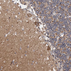 Invitrogen CaMKII delta Polyclonal Antibody 100 &mu;L; Unconjugated:Antibodies,