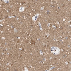 Invitrogen CaMKII delta Polyclonal Antibody 100 &mu;L; Unconjugated:Antibodies,