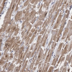 Invitrogen CaMKII delta Polyclonal Antibody 100 &mu;L; Unconjugated:Antibodies,
