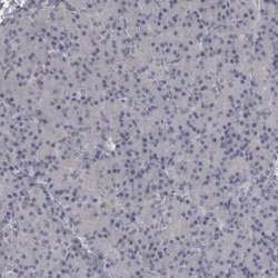 Invitrogen CaMKII delta Polyclonal Antibody 100 &mu;L; Unconjugated:Antibodies,