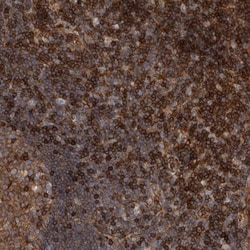 Invitrogen PKC eta Polyclonal Antibody 100 &mu;L; Unconjugated:Antibodies,