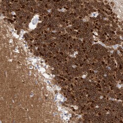 Invitrogen CaMKII beta Polyclonal Antibody 100 &mu;L; Unconjugated:Antibodies,