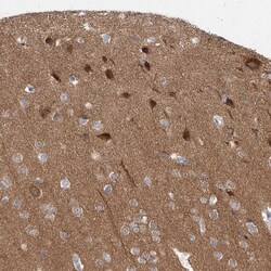 Invitrogen CaMKII beta Polyclonal Antibody 100 &mu;L; Unconjugated:Antibodies,