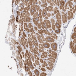 Invitrogen CaMKII beta Polyclonal Antibody 100 &mu;L; Unconjugated:Antibodies,