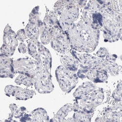 Invitrogen CaMKII beta Polyclonal Antibody 100 &mu;L; Unconjugated:Antibodies,