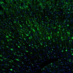 Invitrogen CaMKII beta Polyclonal Antibody 100 &mu;L; Unconjugated:Antibodies,