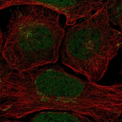 Invitrogen Claspin Polyclonal Antibody 100 &mu;L; Unconjugated:Antibodies,