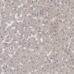 Invitrogen MST3 Polyclonal Antibody 100 &mu;L; Unconjugated:Antibodies,