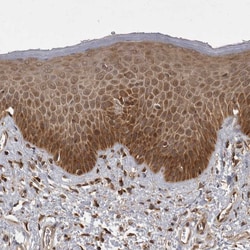 Invitrogen MST3 Polyclonal Antibody 100 &mu;L; Unconjugated:Antibodies,