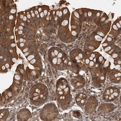 Invitrogen MST3 Polyclonal Antibody 100 &mu;L; Unconjugated:Antibodies,