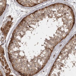 Invitrogen MST3 Polyclonal Antibody 100 &mu;L; Unconjugated:Antibodies,