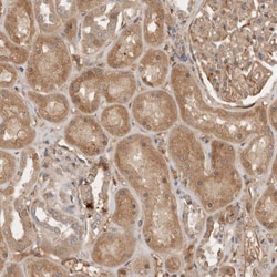 Invitrogen YES1 Polyclonal Antibody 100 &mu;L; Unconjugated:Antibodies,