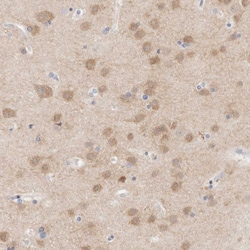 Invitrogen MPP2 Polyclonal Antibody 100 &mu;L; Unconjugated:Antibodies,