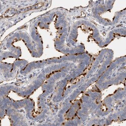 Invitrogen CD59 Polyclonal Antibody 100 &mu;L; Unconjugated:Antibodies,