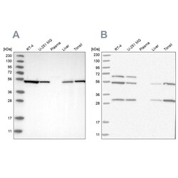 Invitrogen MST3 Polyclonal Antibody 100 &mu;L | Buy Online | Invitrogen&trade; | Fisher Scientific