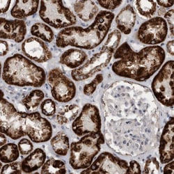 Invitrogen ACADM Polyclonal Antibody 100 &mu;L; Unconjugated:Antibodies,