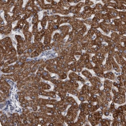 Invitrogen ACADM Polyclonal Antibody 100 &mu;L; Unconjugated:Antibodies,