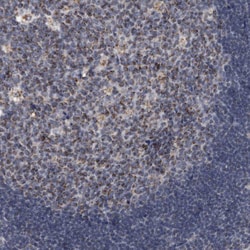 Invitrogen ACADM Polyclonal Antibody 100 &mu;L; Unconjugated:Antibodies,