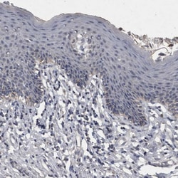 Invitrogen ACADM Polyclonal Antibody 100 &mu;L; Unconjugated:Antibodies,
