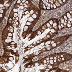 Invitrogen DAAM1 Polyclonal Antibody 100 &mu;L; Unconjugated:Antibodies,