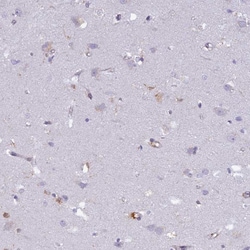 Invitrogen ADAP Polyclonal Antibody 100 &mu;L; Unconjugated:Antibodies,