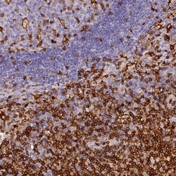 Invitrogen ADAP Polyclonal Antibody 100 &mu;L; Unconjugated:Antibodies,