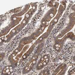 Invitrogen Nectin 1 Polyclonal Antibody 100 &mu;L | Buy Online | Invitrogen&trade; | Fisher Scientific