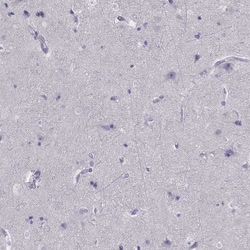 Invitrogen SPINT3 Polyclonal Antibody 100 &mu;L; Unconjugated:Antibodies,