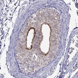 Invitrogen SPINT3 Polyclonal Antibody 100 &mu;L; Unconjugated:Antibodies,
