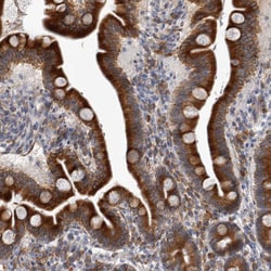 Invitrogen MINPP1 Polyclonal Antibody 100 &mu;L; Unconjugated:Antibodies,
