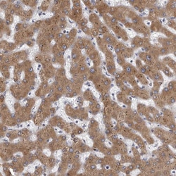 Invitrogen MINPP1 Polyclonal Antibody 100 &mu;L; Unconjugated:Antibodies,