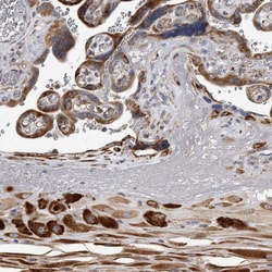 Invitrogen MINPP1 Polyclonal Antibody 100 &mu;L; Unconjugated:Antibodies,