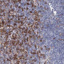 Invitrogen FCER1G Polyclonal Antibody 100 &mu;L; Unconjugated:Antibodies,