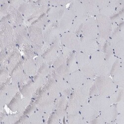 Invitrogen FCER1G Polyclonal Antibody 100 &mu;L; Unconjugated:Antibodies,