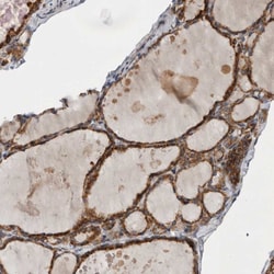 Invitrogen GANAB Polyclonal Antibody 100 &mu;L; Unconjugated:Antibodies,