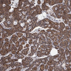 Invitrogen MAN2A1 Polyclonal Antibody 100 &mu;L; Unconjugated:Antibodies,