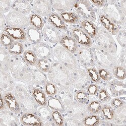 Invitrogen Kir1.1 (KCNJ1) Polyclonal Antibody 100 &mu;L; Unconjugated:Antibodies,