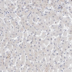 Invitrogen Kir1.1 (KCNJ1) Polyclonal Antibody 100 &mu;L; Unconjugated:Antibodies,