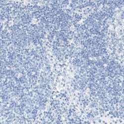 Invitrogen Kir1.1 (KCNJ1) Polyclonal Antibody 100 &mu;L; Unconjugated:Antibodies,