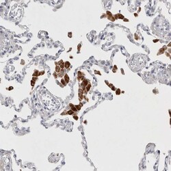 Invitrogen LYAG Polyclonal Antibody 100 &mu;L; Unconjugated:Antibodies,