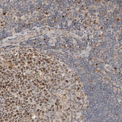 Invitrogen CK1 gamma-3 Polyclonal Antibody 100 &mu;L; Unconjugated:Antibodies,
