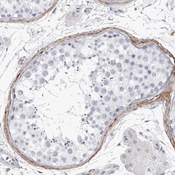 Invitrogen COL26A1 Polyclonal Antibody 100 &mu;L; Unconjugated:Antibodies,