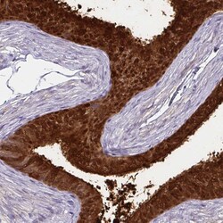 Invitrogen ECM1 Polyclonal Antibody 100 &mu;L | Buy Online | Invitrogen&trade; | Fisher Scientific