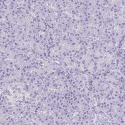 Invitrogen ECM1 Polyclonal Antibody 100 &mu;L | Buy Online | Invitrogen&trade; | Fisher Scientific