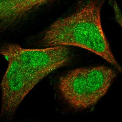 Invitrogen SENP7 Polyclonal Antibody 100 &mu;L; Unconjugated:Antibodies,