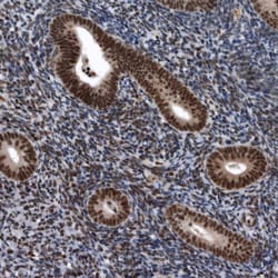 Invitrogen SENP7 Polyclonal Antibody 100 &mu;L; Unconjugated:Antibodies,