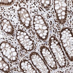 Invitrogen SENP7 Polyclonal Antibody 100 &mu;L; Unconjugated:Antibodies,